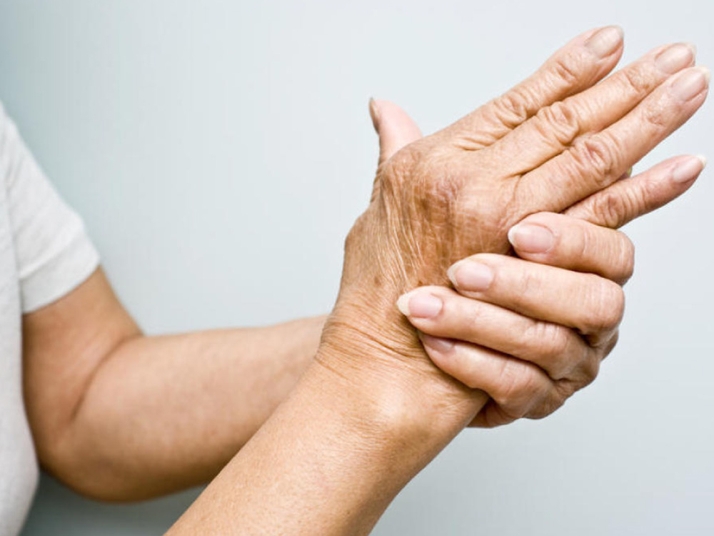 artritis reumatoide, te y artritis