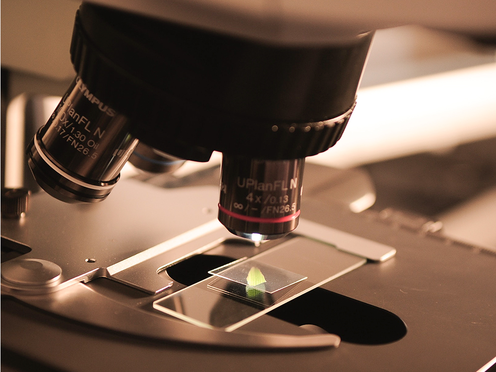 Té verde. Alzheimer, Galato de epigalocatequina